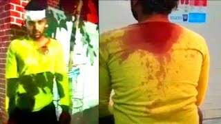 Gang Attack On An Person | 4 Persons Arrested | In Hyderabad Mallapally Afzal Sagar |