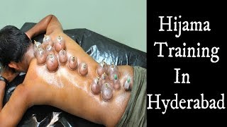 Hijama Training An Treatment For All In Hyderabad Charminar By Dr. Suja Khan .