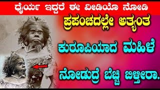 ಪ್ರಪಂಚದಲ್ಲೇ ಅತ್ಯಂತ ಕುರೂಪಿಯಾದ ಮಹಿಳೆ  ನೋಡುದ್ರೆ ಬೆಚ್ಚಿ ಬಿಳ್ತೀರಾ | Top Kannada TV