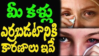 Causes And Types Of Eye Infection I Health Tips I RECTV INDIA