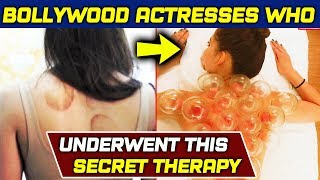 Bollywood Actresses Undergoes Painful Cupping Therapy To Look Beautiful