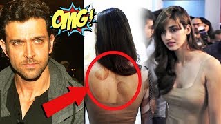 Hrithik Roshan Accused Of Flirting With Disha Patani, Disha Patani Spotted With Weird Marks On Body