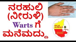How to get rid of Warts Kannada |How to remove Warts Naturally at home | Kannada Sanjeevani