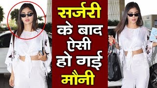 Mouni Roy's Plastic Surgery Goes Wrong? | Watch Video