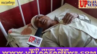 विधुत करंट से संविदा कर्मी घायल, गलत शट डाउन से हुयी घटना || UP TAAZA NEWS