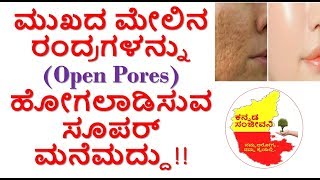 How to remove Open Pores Naturally Kannada | How to get rid of Open pores | Kannada Sanjeevani