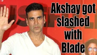 When Akshay Kumar was slashed with a blade