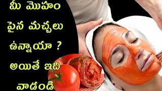 మీ మొహం పైన మచ్చలు ఉన్నాయా ? అయితే ఇది వాడండి |  Skin Brightening Tomato Facial | Telugu Health Tips