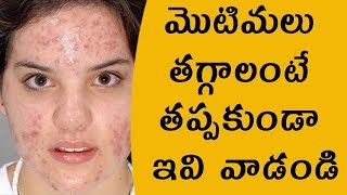 మొటిమలు తగ్గాలంటే తప్పకుండా ఇవి వాడండి |  pimples removal on face at home for men in telugu