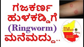 Home Remedies for Ringworm in Kannada | Hulkaddi Gajakarna manemaddu  | Kannada Sanjeevani