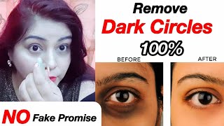 काले घेरे ग़ायब - How to Remove Dark Circles - DIY Under Eye Cream | JSuper kaur
