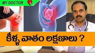 Types Of Arthritis I Rheumatoid arthritis treatment I Health Tips In Telugu I RECTV INDIA
