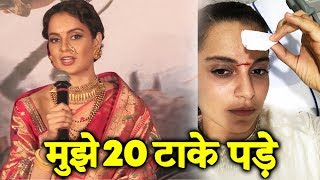 Kangana Ranaut Reaction On Her INJURY At Manikarnika Trailer Launch