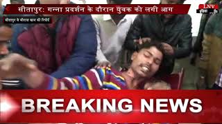 सीतापुर- गन्ना प्रदर्शन के दौरान लगी आग, युवक घायल