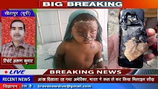 Sitapur : जियो फोन ब्लास्ट होने से 5 वर्षीय मासूम गंभीर रूप से झुलसा - BRAVE NEWS LIVE