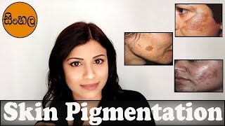 Skin Pigmentation වලට හොඳම Products
