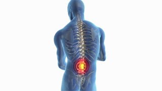 lower back pain ( Spinal Chord ) कभी नहीं होगा अगर उसके कारण जानोगे अगर पहले से है तो उसका उपाय