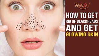 Watch How to Get Rid Of Blackheads and Get Glowing Skin