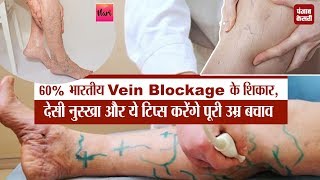 HealthAlert! 60 प्रतिशत भारतीय VeinBlockage के शिकार, सिंपल सा नुस्खा करेगा नसों की नेचुरल सफाई