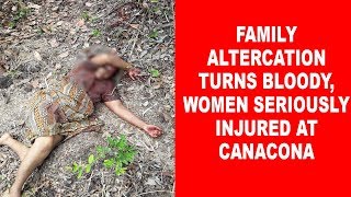 Family Altercation Turns Bloody, Women Seriously Hurt At Canacona