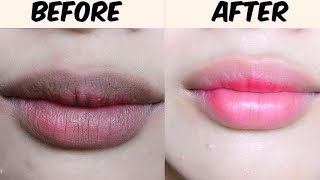 How to get Pink Lips | Lighten Dark Lips Naturally | JSuper kaur