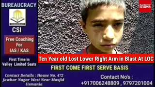Ten Year old Lost Lower Right Arm in Blast At LOC