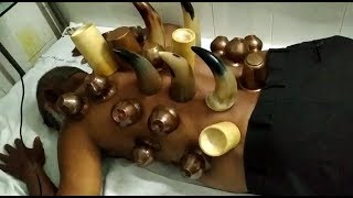 Hijama Done In Shifa Ullah Old Age Home At Hassan Nagar | Dr Quadri Speaks About It |