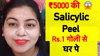 Rs.1 की गोली से Pimples 100% ग़ायब | Homemade Salicylic Peel For Acne | JSuper kaur
