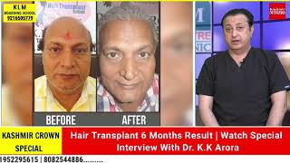 Hair Transplant 6 Months Result | Watch Special Interview With Dr. K.K Arora
