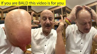 Wow Anupam Kher Dedicated Song For Bald People To Make Them Happy