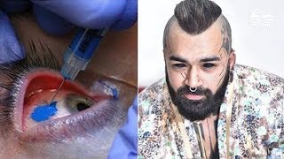 Delhi man becomes first Indian to get eyeballs tattooed