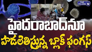 హైదరాబాద్ లో హడలెత్తిస్తున్న బ్లాక్ ఫంగస్ | Black Fungus Cases In Hyderabad | Top Telugu TV