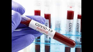 Plasma therapy likely to be dropped from clinical management guidelines on Covid-19: Sources