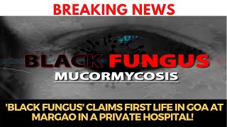 'Black Fungus' claims first life in Goa at Margao! Watch to know symptoms, cause & prevention