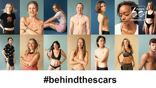 Behind The Scars': The Photo Project Showing All Skin Is Beautiful