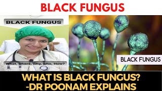 #BlackFungus | What is it? Explained by Dr Poonam Sambhaji