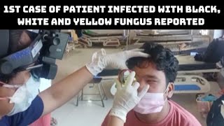 1st Case Of Patient Infected With Black, White And Yellow Fungus Reported from UP’s Ghaziabad