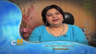 Skin care during rains to keep it from from skin infections tips by dermatologist