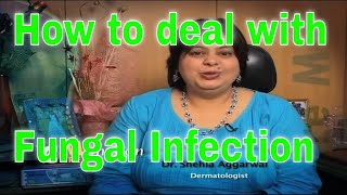 How to deal with fungal infection tips by dermatologist फंगल इन्फेशन से कैसे बचें