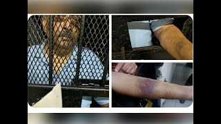 Watch: Pictures of fugitive Mehul Choksi behind bars in Dominica, 'Injury marks' seen on his body
