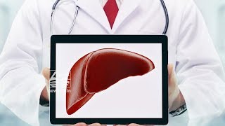 fatty liver: facts