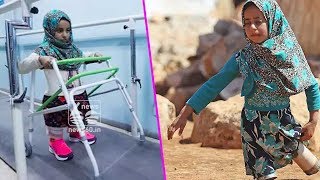 syrian girl maya merhi new legs