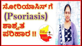 Home Remedies for Psoriasis in Kannada | Psoriasis treatment | Kannada Sanjeevani
