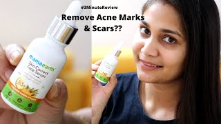 Removes Acne Marks & Scars?  Skin Correct Serum | Is it worth buying? #3minuteReview | Nidhi Katiyar
