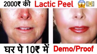 Milk Peel for Bright Skin | Remove Sun Tan, Dark Spots with Milk Facial | JSuper Kaur