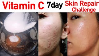Vitamin C face pack for Fair Skin | Glowing Skin Remedy | JSuper Kaur