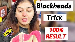 How I Remove BLACKHEADS at home | Backheads Tricks | JSuper Kaur