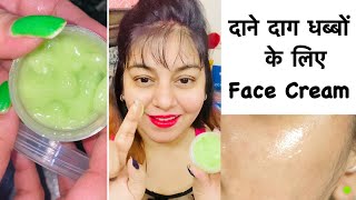 Green Tea Skin Brightening Face Cream for Acne, Dark Spots, Dark Circles | JSuper Kaur