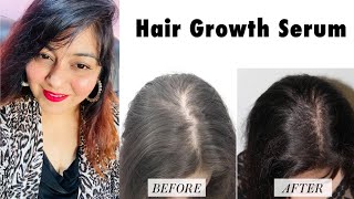 Best Serum for Hair Growth! | Mamaearth new Launch | JSuper Kaur