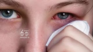 Eye Cancer: Symptoms and Signs